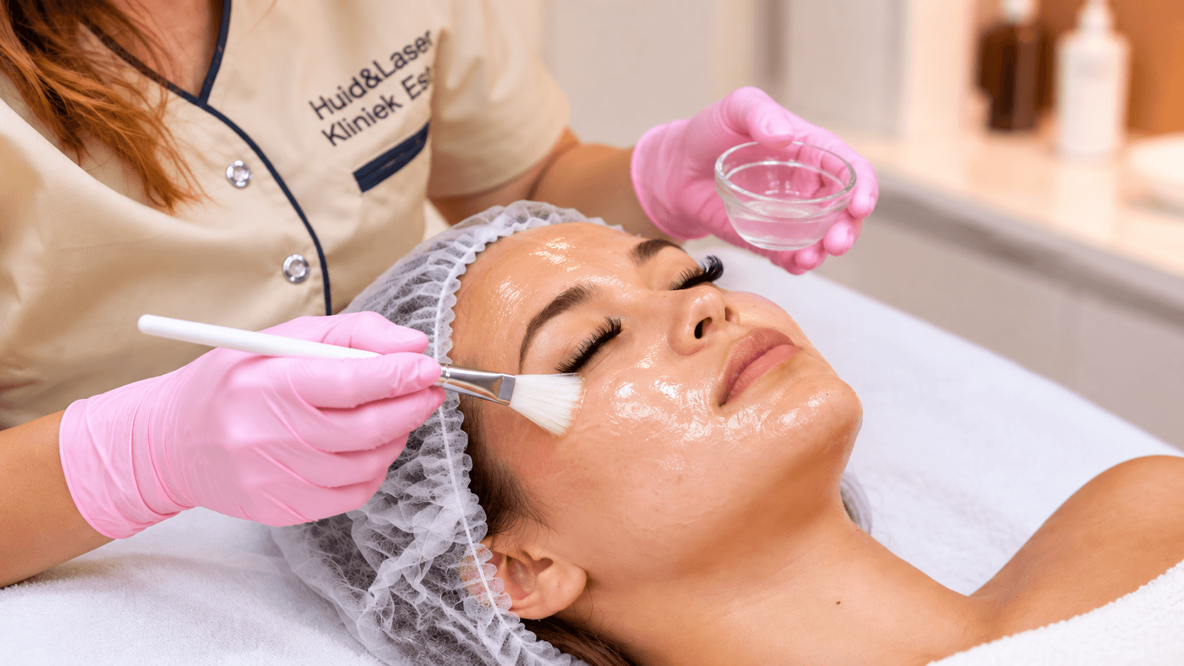 Acne Medische Behandeling