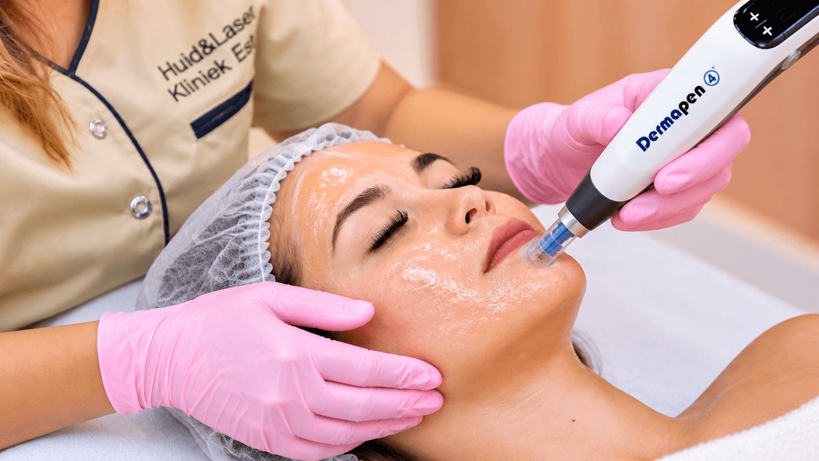 Dermpen met peeling behandeling